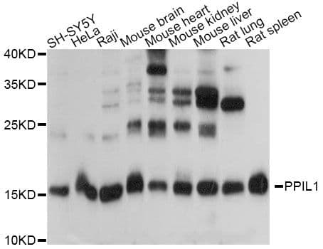 Polyclonal Rabbit anti-Human PPIL1 Antibody (WB)