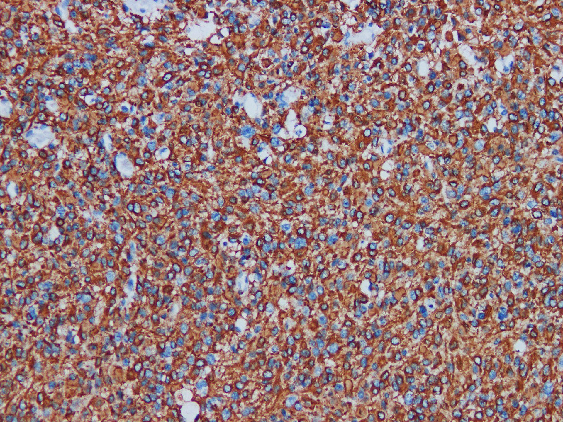 GFAP Antibody