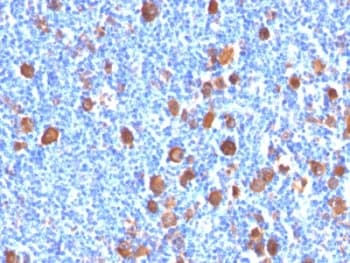 FSCN1 / Fascin Antibody (clone FSCN1/416)