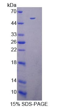 Mouse DAPK3 / ZIP Kinase Protein (Recombinant His-T7)