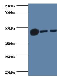 Polyclonal Rabbit anti-Human IDH1 / IDH Antibody (aa1-240, IHC, WB)