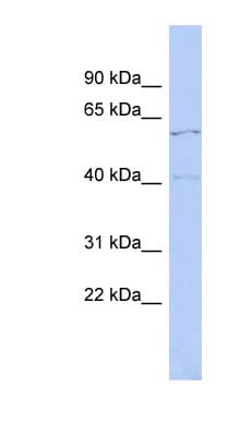 Polyclonal Rabbit anti-Human ZNF384 Antibody (aa195-244, WB)