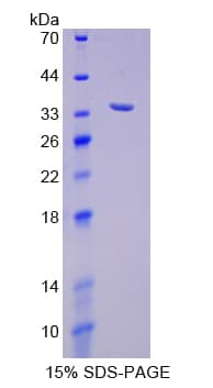 Human p66 / SHC Protein (Recombinant His-T7)