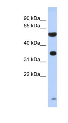 PRSS48 / ESSPL Antibody (N-Terminus)