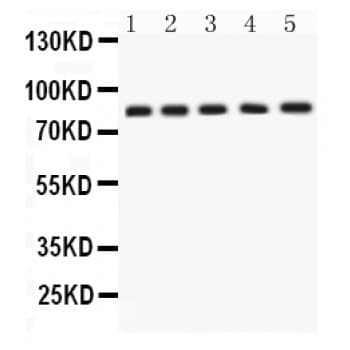 Polyclonal Rabbit anti-Human APLP1 / APLP-1 Antibody (aa82-112, IHC, WB)