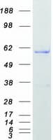 Human HNRNPK / hnRNP K Protein (Recombinant Myc-DDK (Flag))