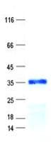Human HOXC11 Protein (Recombinant His, N-Terminal)