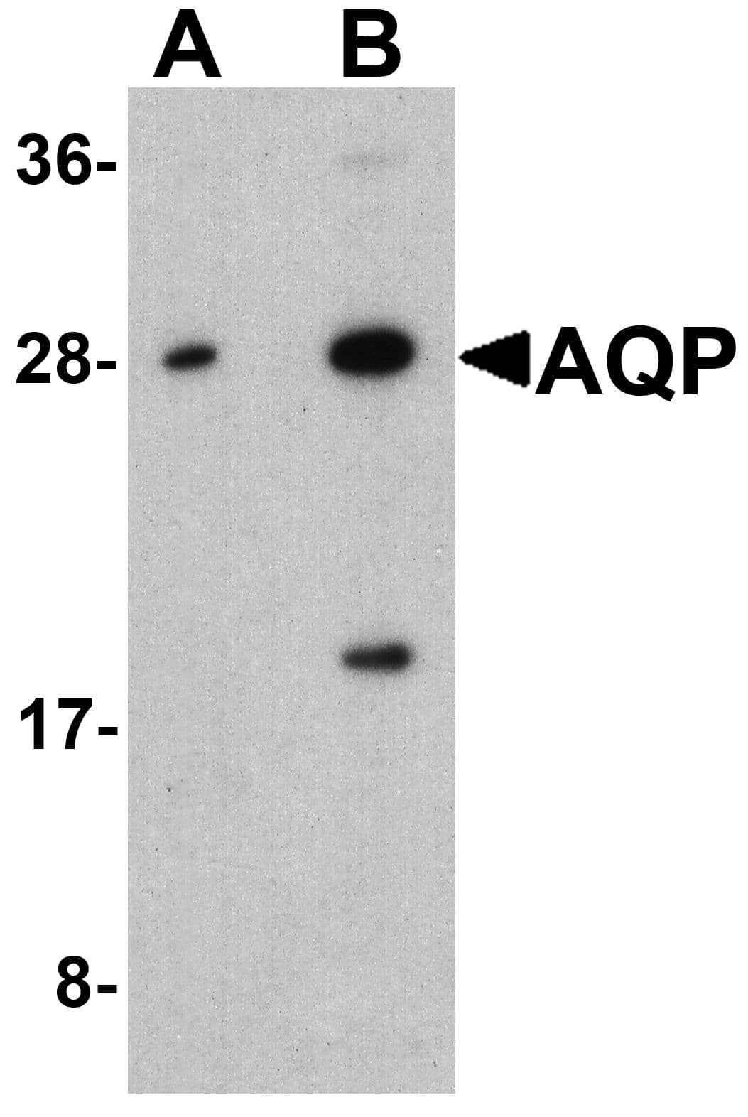 AQP2 / Aquaporin 2 Antibody