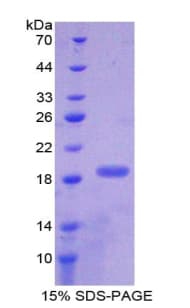 Human PTN / Pleiotrophin Protein (Recombinant His-T7)