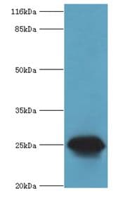 CSHL1 / CSH-Like 1 Antibody (aa1-128)