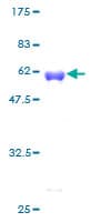 Human PCNA Protein (Recombinant GST)