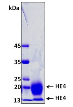Human WFDC2 / HE4 Protein (Recombinant 8His, N-terminus)