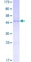 Human MANF / ARMET Protein (Recombinant GST)