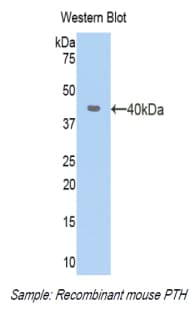 PTH / Parathyroid Hormone Antibody (aa26-115)