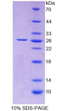 Rat Apolipoprotein A-V (Recombinant His)