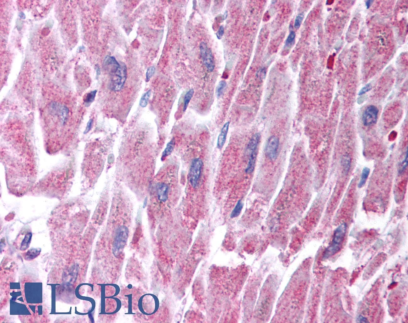 KCNQ2 Antibody (aa154-203)