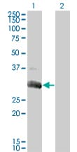 DGUOK / Deoxyguanosine Kinase Antibody (clone 3E9)