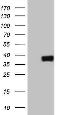 Monoclonal Mouse anti-Human ATF1 Antibody (clone OTI8G3, IHC, WB)