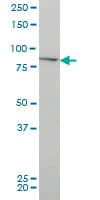 CHUK / IKKA / IKK Alpha Antibody (clone 4B8)