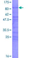 Human CIR1 Protein (Recombinant GST)