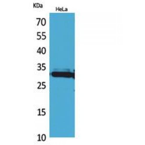 Polyclonal Rabbit anti-Human IL-33 Antibody (121-170 aa, Internal, WB)