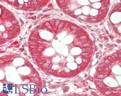 IHC-plus™ PPP1R16A Antibody (aa83-464)