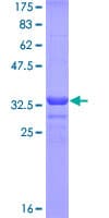 Human ALPI / Alkaline Phosphatase Protein (Recombinant GST, N-terminus)