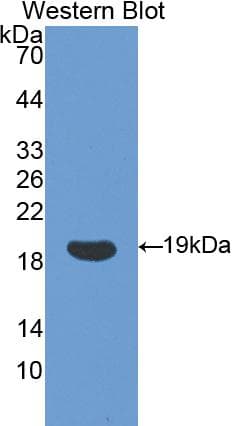 PPIA / Cyclophilin A Antibody (aa2-164, PE)