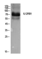 Polyclonal Rabbit anti-Human IL12RB1 / CD212 Antibody (WB)