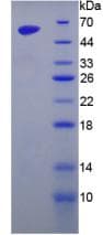 Mouse GOLM1 / GP73 / GOLPH2 Protein (Recombinant His-GST, N-terminus)