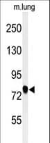 Polyclonal Rabbit anti-Human SEMA3C / Semaphorin 3C Antibody (aa592-620, WB)
