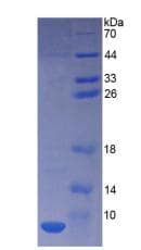 Human TMSB4X / Thymosin Beta-4 Protein (Recombinant His)