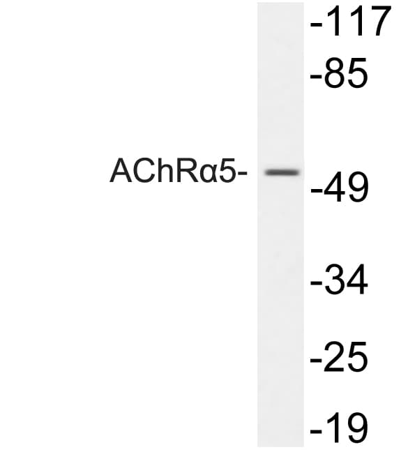 CHRNA5 Antibody (aa166-215)