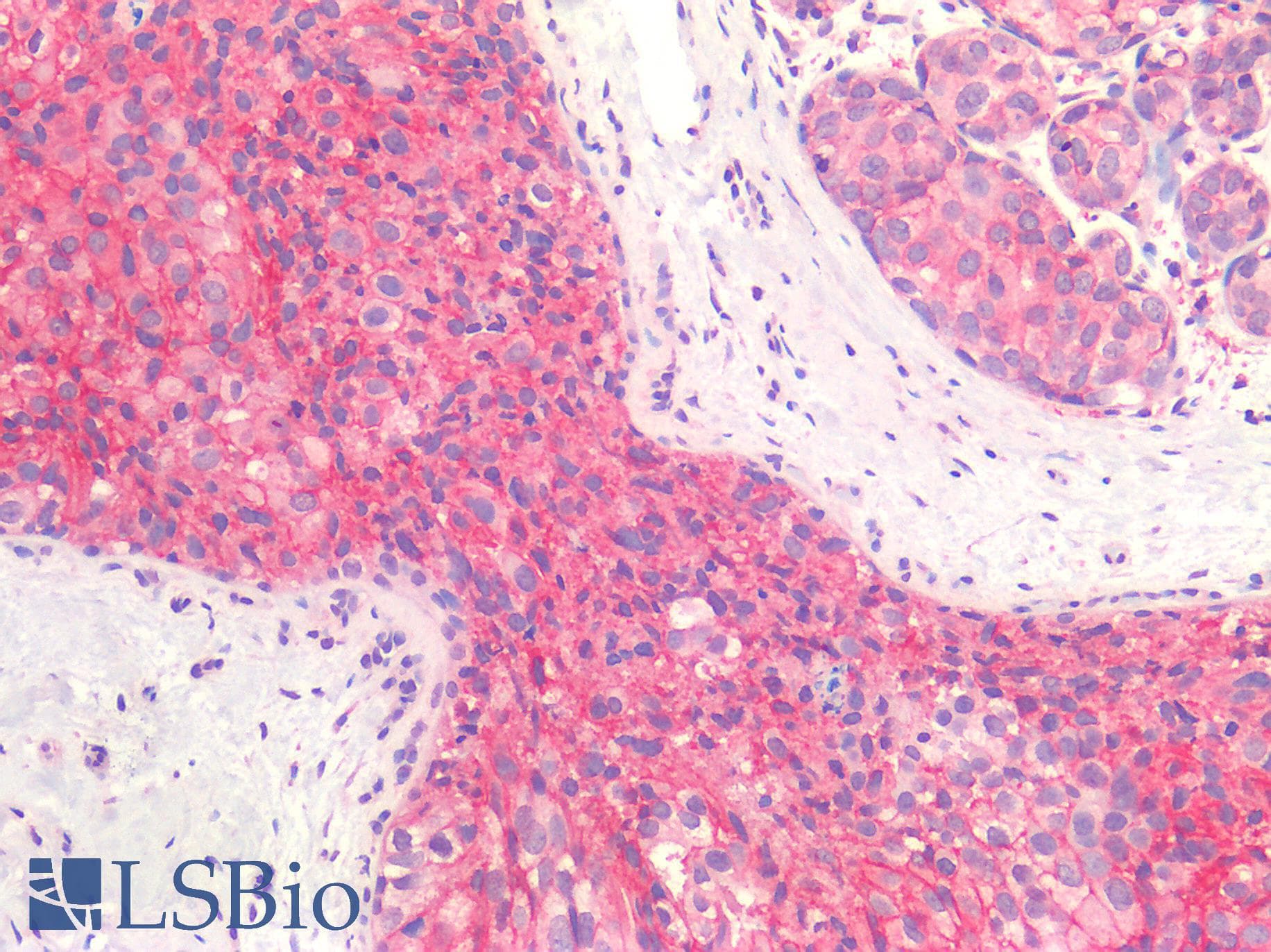 PathPlus™ ERBB2 / HER2 Antibody