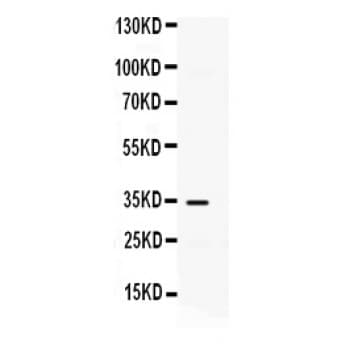 CXCL10 / IP-10 Antibody (aa22-98)