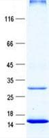 Human YPEL2 Protein (Recombinant His, N-Terminal)