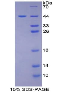 Human CD2AP Protein (Recombinant His-T7)