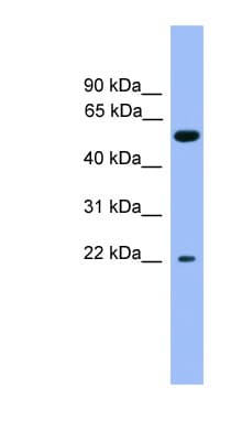 Cochlin / COCH Antibody (C-Terminus)
