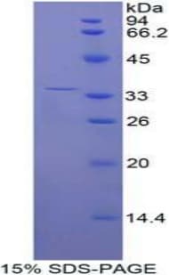 Human ENPP2 / Autotaxin Protein (Recombinant His-T7)