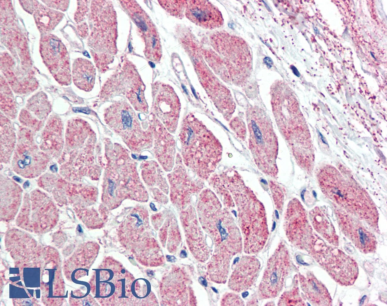 IHC-plus™ Polyclonal Goat anti-Human NPPA / ANP Antibody (aa137-150, IHC, WB)