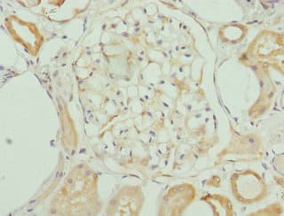 KHDRBS3 / SLM2 Antibody