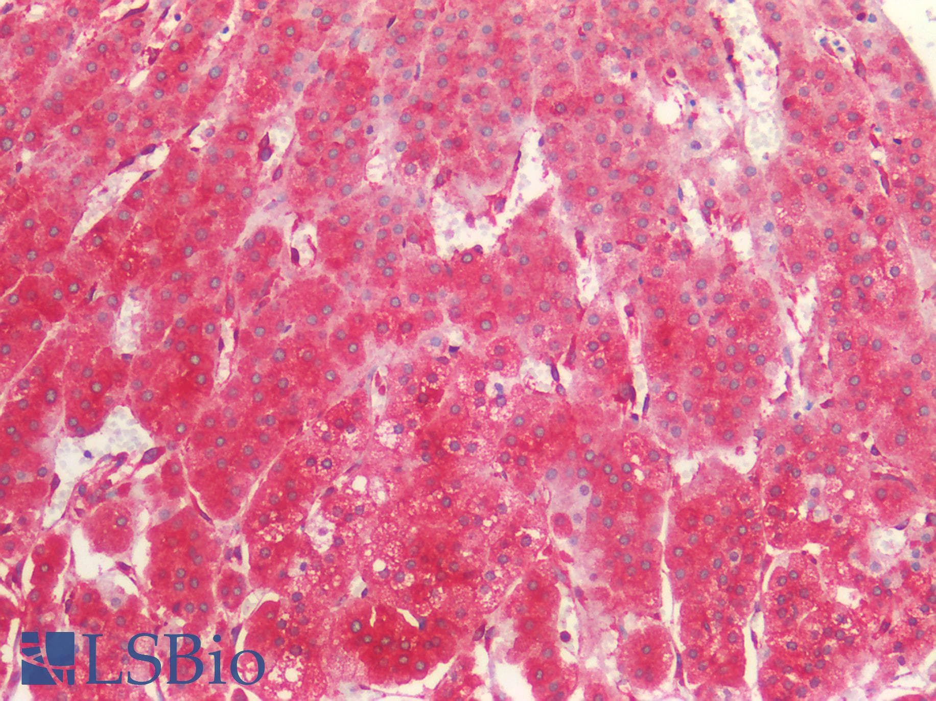 IHC-plus™ Polyclonal Rabbit anti-Human L1CAM Antibody (IHC)