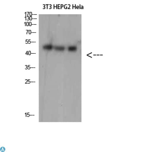 Polyclonal Rabbit anti-Human SPOP Antibody (WB)