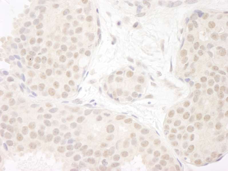 DDX23 / PRP28 Antibody (aa1-50)
