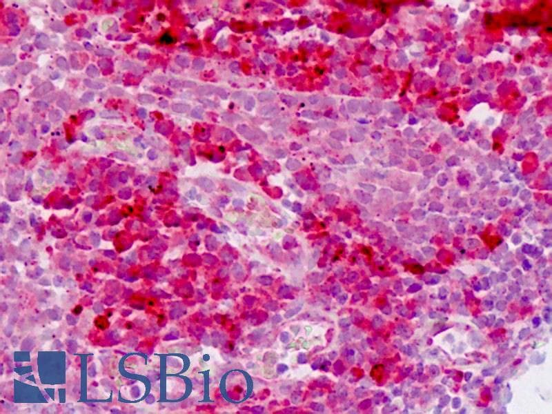 IHC-plus™ Polyclonal Rabbit anti-Human E2F1 Antibody (aa342-371, IHC, WB)