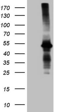 AMT Antibody (aa146-403, clone OTI6F4)