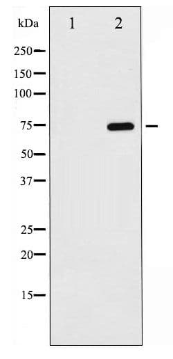 RELA / NFKB p65 Antibody (phospho-Ser529)