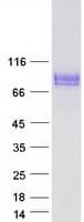 Human CD36 Protein (Recombinant Myc-DDK (Flag))