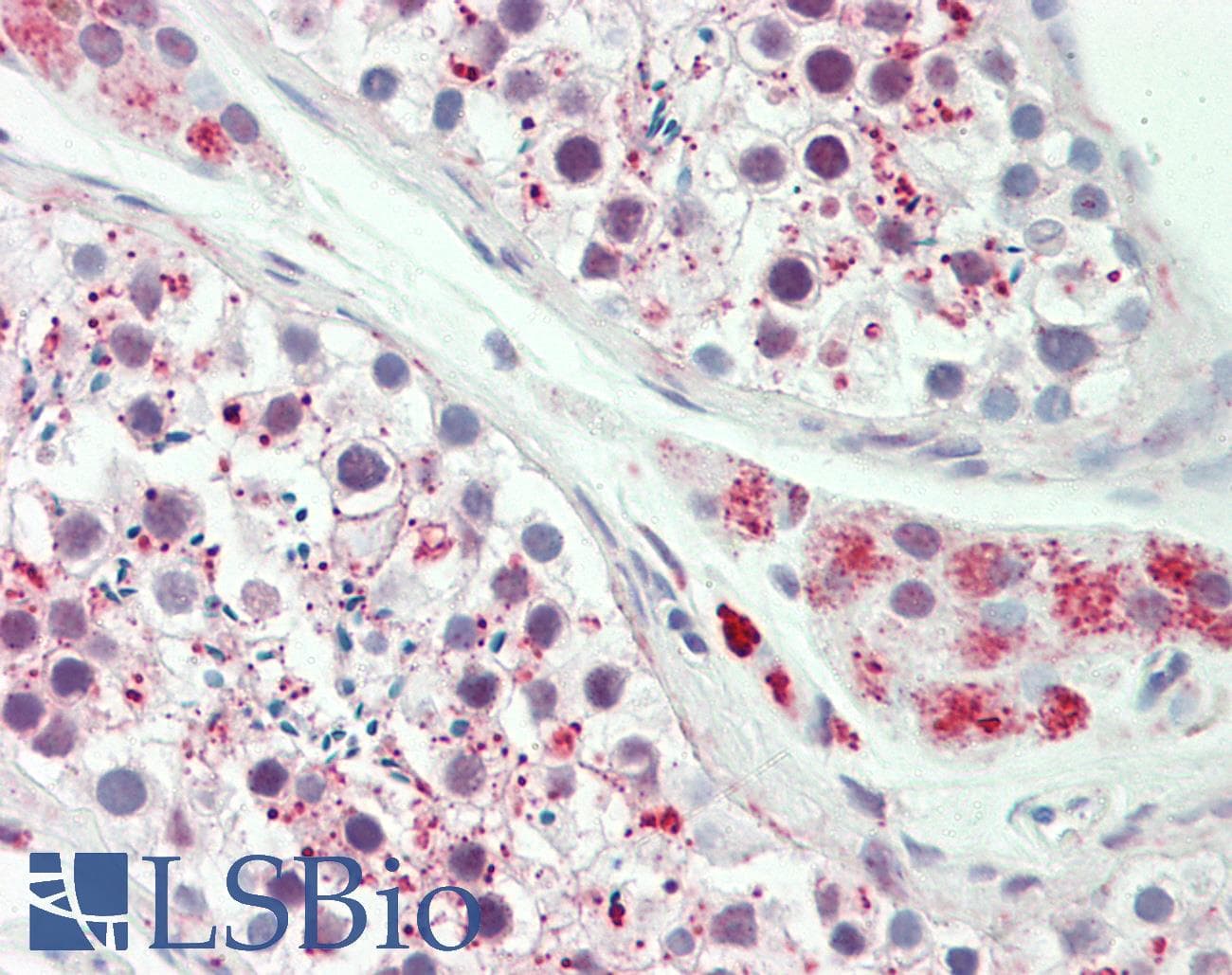 ODF3 Antibody (aa96-145)