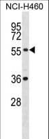 XKRX Antibody (aa317-345)